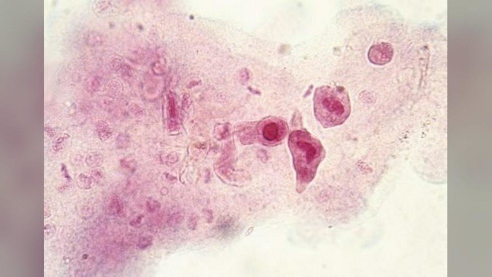 Texas gov. issues disaster declaration after BRAINEATING amoeba found