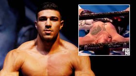 'Is this a comedy sketch?': Tyson Fury's brother Tommy mocked by boxing fans as foe who had NEVER WON gets oxygen after KO (VIDEO)