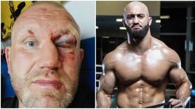 'Only fight in competition': MMA veteran Kharitonov shows horror eye injury but UFC's Yandiev DENIES using knuckleduster in attack