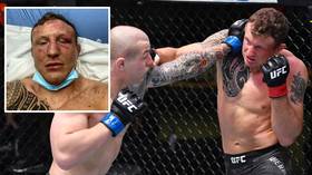 'The goal remains the same': Jack Hermansson reveals broken EYE SOCKET after main event loss at UFC Vegas 16