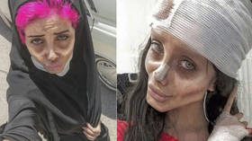 ‘Corpse Bride’ resurrection: Iran’s ‘Zombie Angelina Jolie’ leaves jail days after being slapped with 10-year sentence