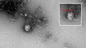 Siberian scientists photograph ‘British variant’ of Covid-19 for first time while studying structure in significant breakthrough