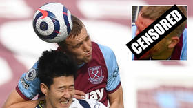 ‘He’s a monster!’: Fans hail heroics of West Ham’s Soucek as he suffers GRUESOME gash – but plays on anyway (GRAPHIC PHOTOS)