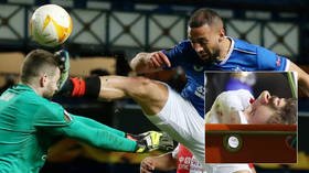 Knockout tie: Goalkeeper suffers fractured skull from horror kung-fu kick in UEFA game mired in claims of racism & assault (VIDEO)