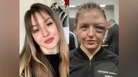 ‘Before and after’: German boxing starlet Cheyenne Hanson shows off horror head injuries after clash with Ukrainian fighter