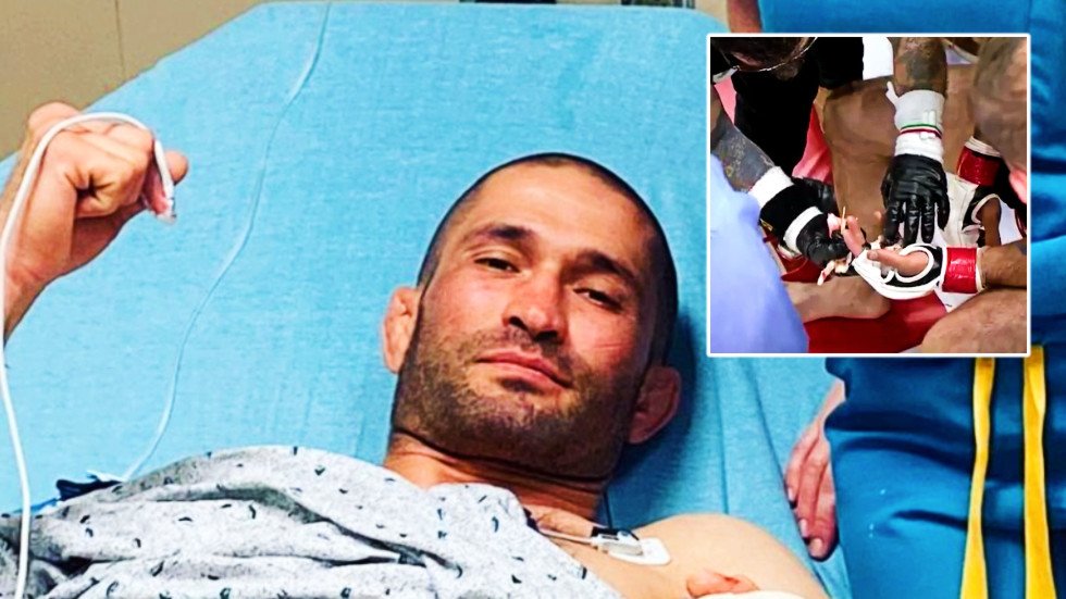 ‘He tried to hide it’ MMA fighter who lost finger wanted to go on