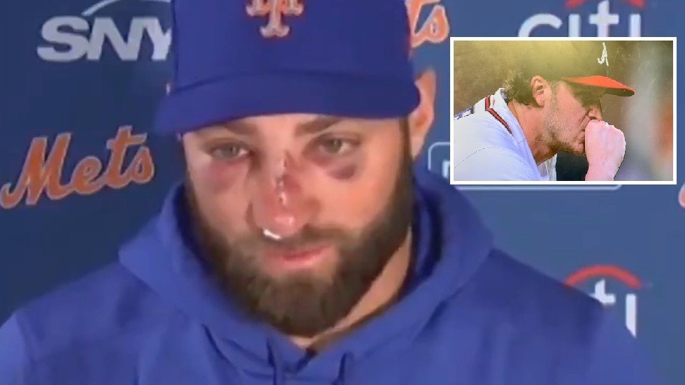 Mets' Kevin Pillar Hit in Face by 94-mph Fastball