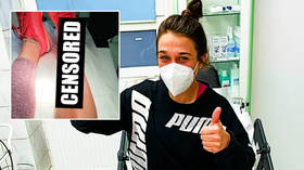 ‘What did she kick, a circular saw?’ Polish UFC star Jedrzejczyk displays horrific gash after training accident (GRAPHIC PHOTOS)