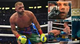 Battered Billy Joe Saunders still in hospital and set for surgery on shattered orbital bone after beating by Canelo (VIDEO)