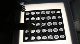 Piece of mind? Man incapable of feeling fear after having part of his BRAIN surgically removed