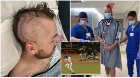 Baseball star Zombro ‘can’t wait to get back out there’ as he shows scars from brain surgery after being hit by ball (GRAPHIC)