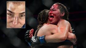 ‘Hard as nails’: Blood-soaked UFC fighter & OnlyFans star Jessica Eye STICKS OUT TONGUE after suffering horror wound (GRAPHIC)