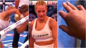 ‘I had one arm’: ‘Blonde Bomber’ boxer wins latest fight on razor-thin decision despite breaking her hand in second round (VIDEO)