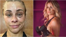 Not on the same Paige: Bare-knuckle stunner VanZant’s future ‘up in the air’ as star ponders MMA return