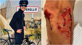 ‘Becoming common occurrence in London’: Brit cycling star left bloodied after being robbed of $14K bike by machete-wielding thugs