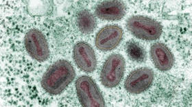 FBI & CDC investigate ‘smallpox’ vials at big pharma facility – media