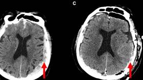 World’s first scan of dying brain reveals final moments