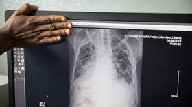 WHO issues warning on tuberculosis