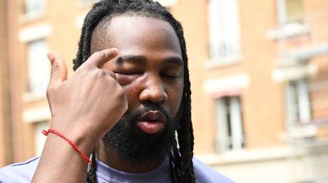 French anti-cop activist claims police brutality (VIDEO)