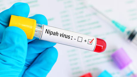No need for panic over Nipah virus &ndash; Indian doctor