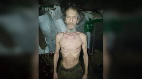 Starvation scandal rocks corruption-plagued Ukrainian military (PHOTOS)