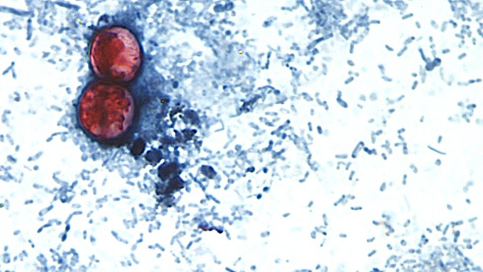 First two US deaths linked to diarrhea-inducing parasite confirmed