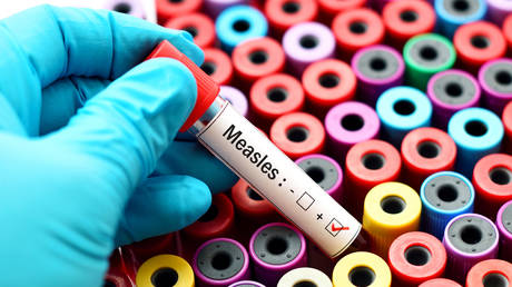South Africa records over 3,400 measles cases