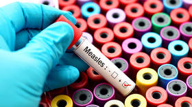 South Africa records over 3,400 measles cases