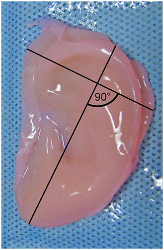 Schematic representation of length and width measurements. (Image from plosone.org) )