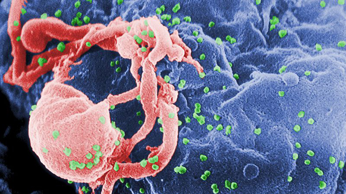Scanning electron micrograph of HIV-1 (in green) budding from cultured lymphocyte (Image from wikipedia.org)