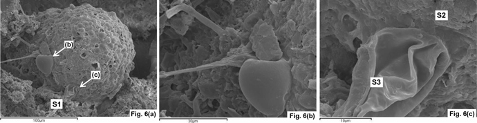 Researchers say, this could be a 'hystrichosphere,' a fossilized dinoflagellate cyst. (University of Cardiff)