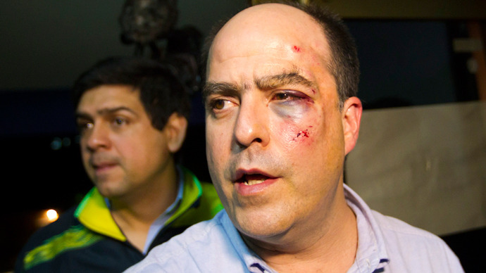 Tensions spill over into physical brawl at Venezuelan assembly (VIDEO)