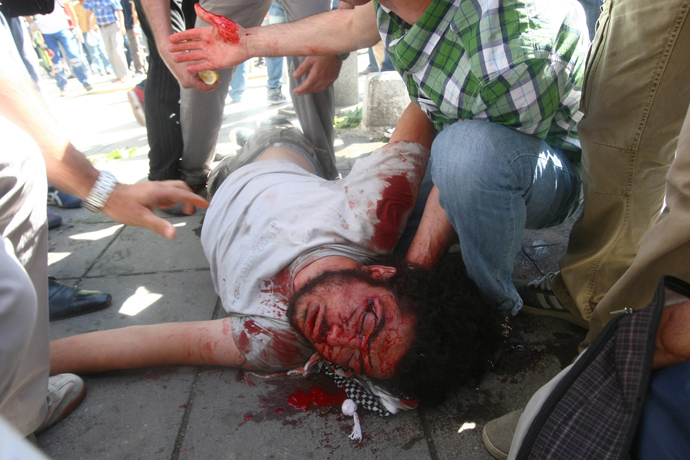 Protestors take care of an injured demonstrator during a demonstration in support of protests in Istanbul and against the Turkish Prime Minister and his ruling Justice and Development Party (AKP), in Ankara, on June 1, 2013 (AFP Photo / Adem Altan)