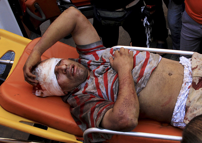 A man injured from clashes between supporters of Egyptian President Mohamed Mursi and anti-Morsi protesters lies on a stretcher in Sedy Gaber in Alexandria, June 28, 2013. (Reuters)
