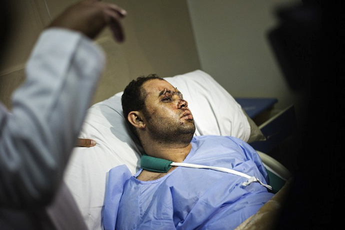 An Egyptian police officer lies on his hospital bed on August 18, 2013 as he recovers from gunshots wounds sustained during clashes with supporters of ousted president Mohammed Morsi, in Cairo. (AFP Photo / Gianluigi Guercia)