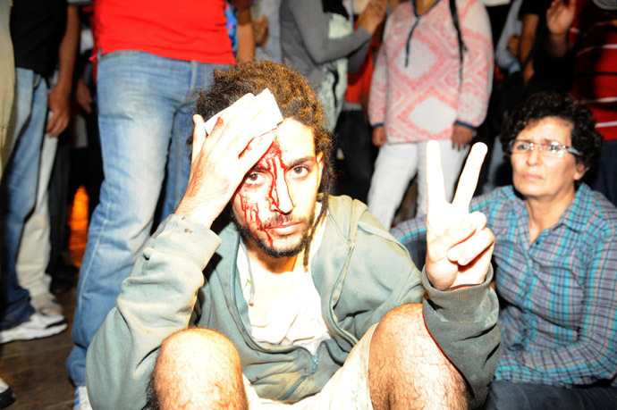 A protester injured during a demonstration on August 2, 2013 in Rabat-Morocco on the release of a Spanish paedophile, Daniel Fino Galvan who raped 11 local children was pardoned by the Moroccan King Mohammed VI. (AFP Photo/Fadel Senna)
