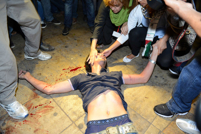 Protesters help an injured person during a demonstration on August 2, 2013 in Rabat-Morocco on the release of a Spanish paedophile, Daniel Fino Galvan who raped 11 local children was pardoned by the Moroccan King Mohammed VI. (AFP Photo/Fadel Senna)