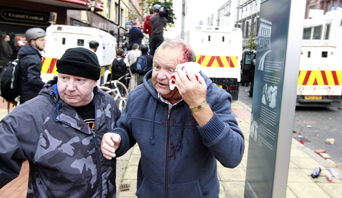 A man covers a wound to his head after loyalist protesters attacked the police with bricks and bottles as they waited for a republican parade to make its way through Belfast City Centre, August 9, 2013. (Reuters/Cathal McNaughton)