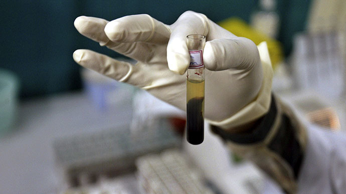 Hospital technician infected dozens with hepatitis C