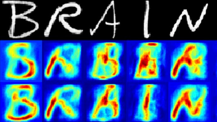 Mind reading: Scientists reconstruct letters from brain scan data