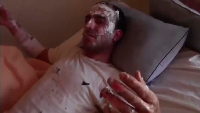 This still image taken from an amateur video off a social media website on August 30, 2013 purportedly shows a wounded man recuperating after an attack that according to the video took place on August 26, 2013 (Reuters / Reuters TV) 