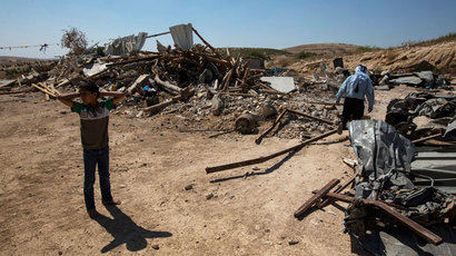 Five Palestinian children injured after Israeli settlers set fire to their home