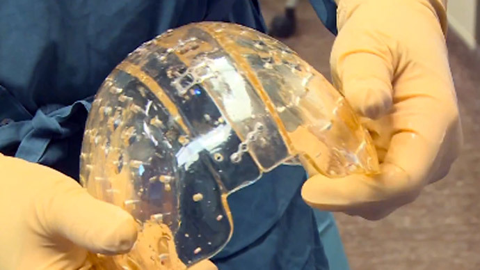 Surgeons perform 'world’s first' implant of entire 3D-printed plastic skull dome (VIDEO)