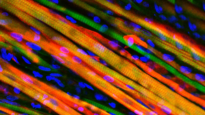 Scientists develop ‘self-healing’ muscles