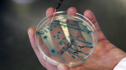 3-minute test to detect superbugs and potentially E. coli & venereal diseases trialed
