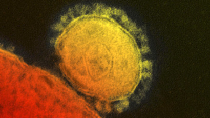 Two hospital workers showing signs of deadly MERS virus in Florida