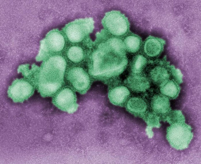 This 2009 Centers For Disease Control and Prevention handout image taken through a microscope, shows a negative-stained image of the swine flu virus H1N1 strain. (AFP Photo)