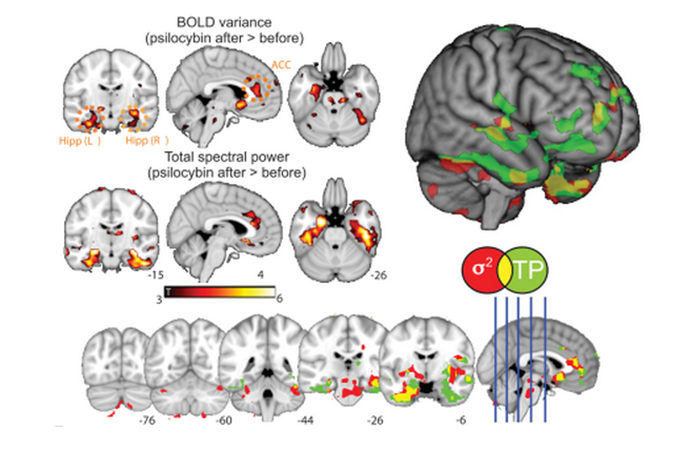 A screenshot from the article "Enhanced repertoire of brain dynamical states during the psychedelic experience" with maps of statistical significance for variance (Ï2) and total spectral power (TP) increases in the human brain after psilocybin infusion.