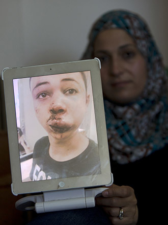 The mother of Tarek Abu Khdeir (portrait), the 15-year-old cousin of the murdered Palestinian youth Mohammad, shows a picture of her son, she took of him at the hospital after he was assaulted by Israeli police in East Jerusalem on July 5, 2014. (AFP Photo / Ahmad Gharabli)