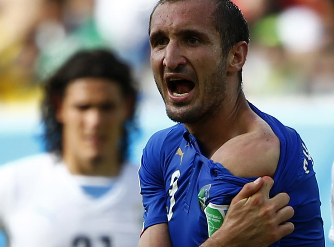 Italy's Giorgio Chiellini shows his shoulder, claiming he was bitten by Uruguay's Luis Suarez, during their 2014 World Cup Group D soccer match at the Dunas arena in Natal June 24, 2014. (Reuters/Tony Gentile)